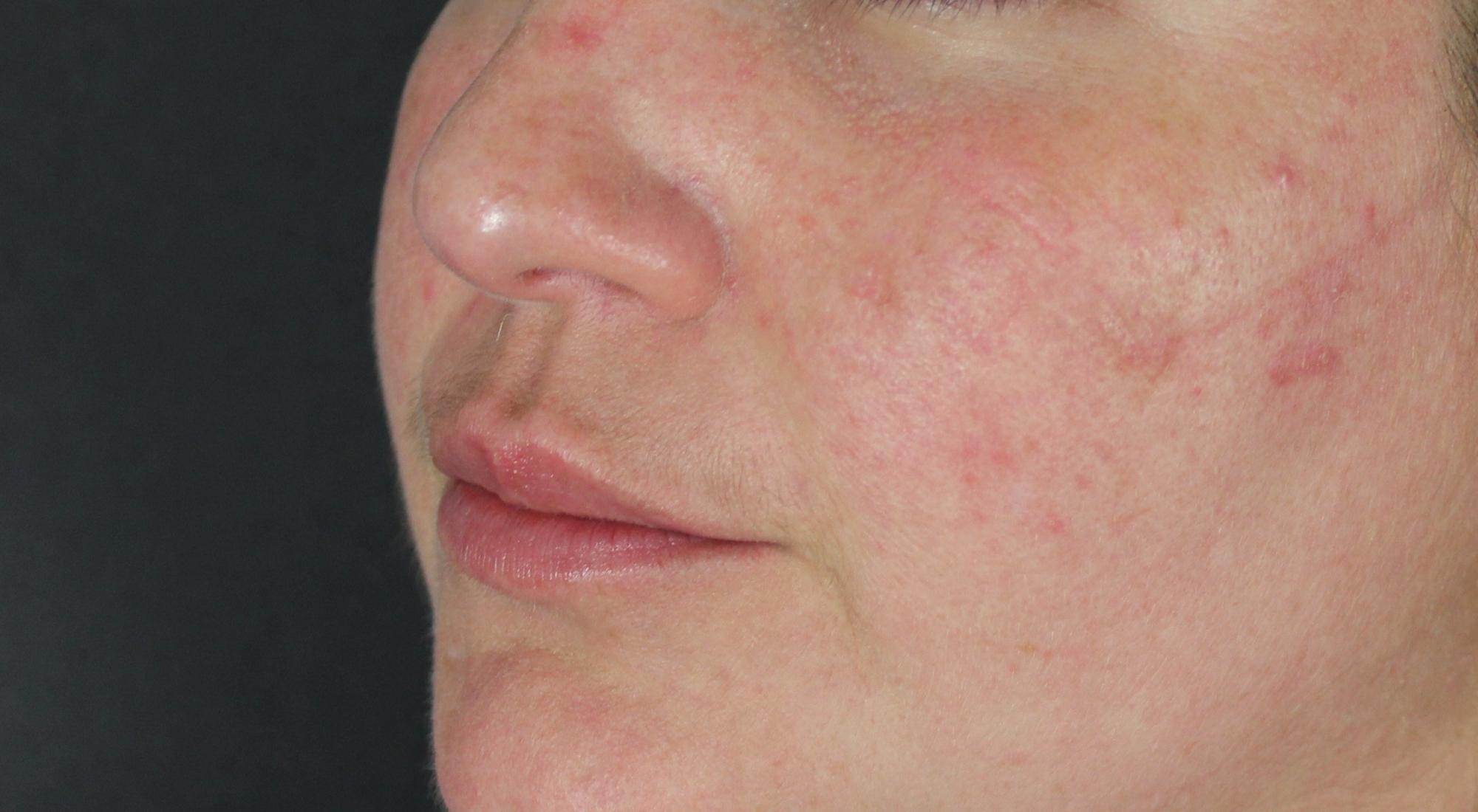 After treatment with Dr Natasha Cook